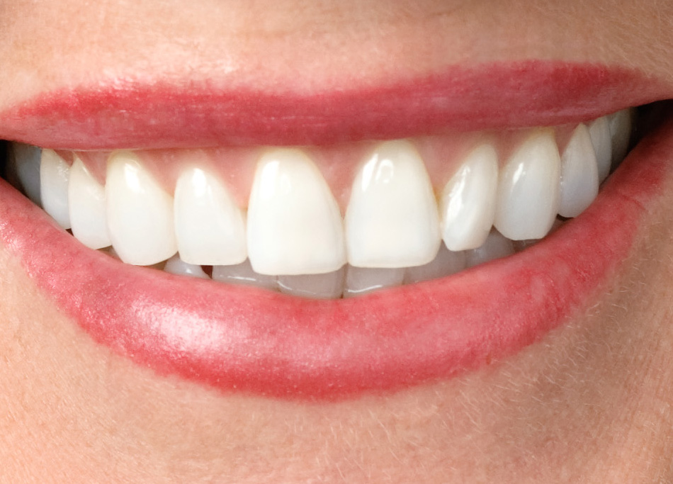 Full-Mouth-Reconstruction.jpg