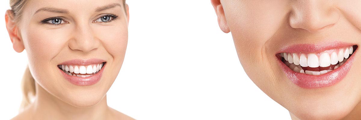 Carmel Cosmetic Dental Care