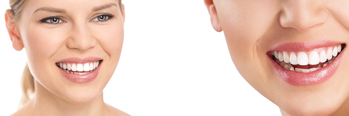 Carmel Cosmetic Dental Services