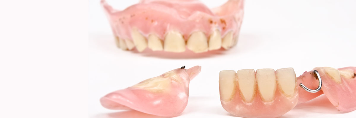 Carmel What Do I Do If I Damage My Dentures?