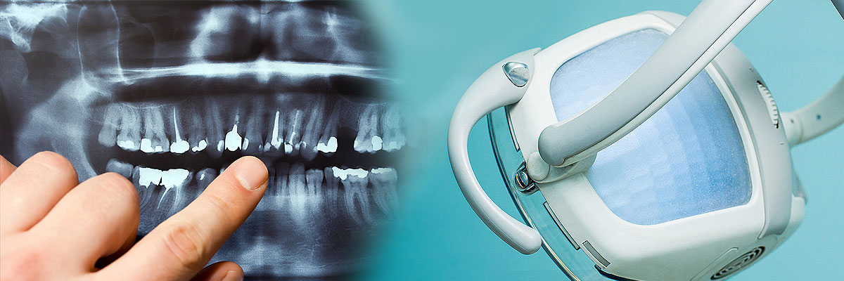 Carmel Dental Cleaning