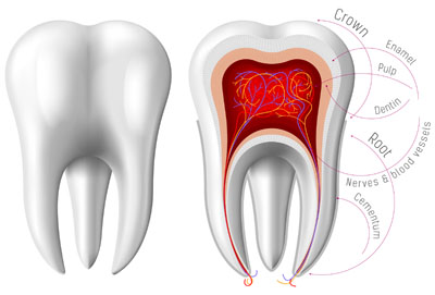 Dental Crowns