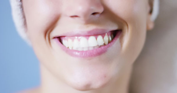 Are There Different Types Of Dental Restoration Services?