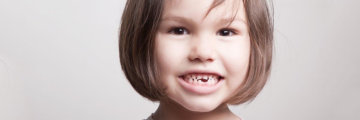 Carmel Dental Restoration