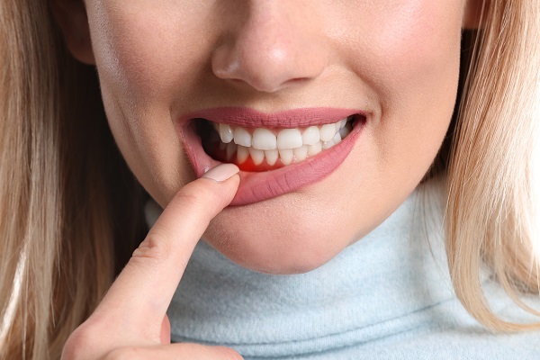 A Step By Step Guide To Understanding Gum Disease