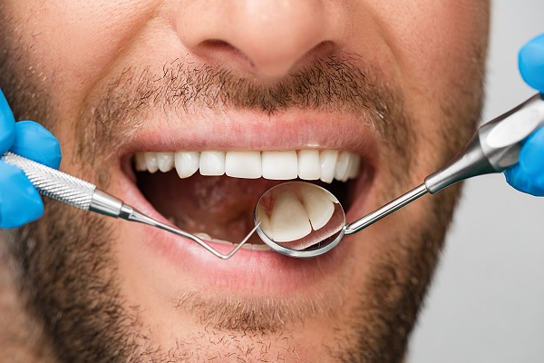 What You Should Know About Gum Disease