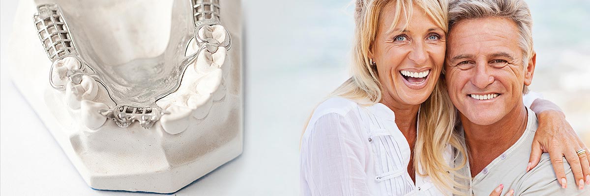 Carmel Implant Supported Dentures