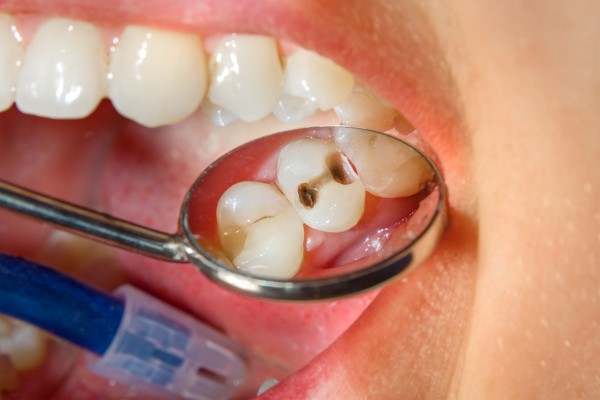 Oral Hygiene Basics Carmel, IN