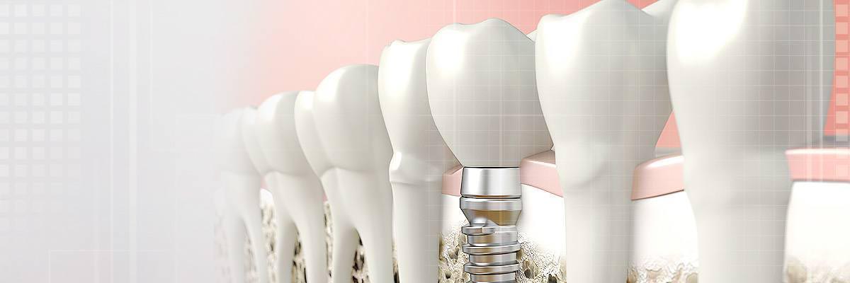 Carmel Periodontics