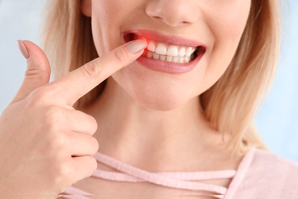 Receding Gums: Will I Need To Get A Gum Graft?