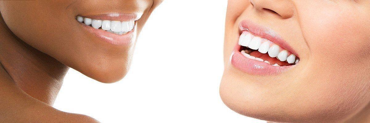 Carmel Dental Restoration