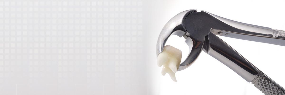Carmel Tooth Extraction