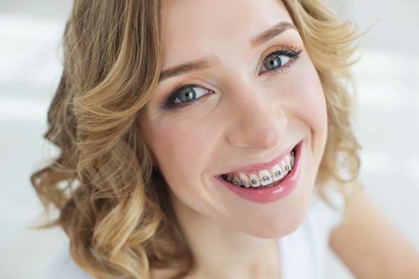 Teeth Whitening and Dental Braces