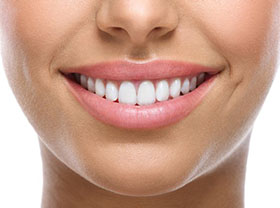 Teeth Whitening and Dental Braces - Smiles in the Village Dentistry Carmel  Indiana